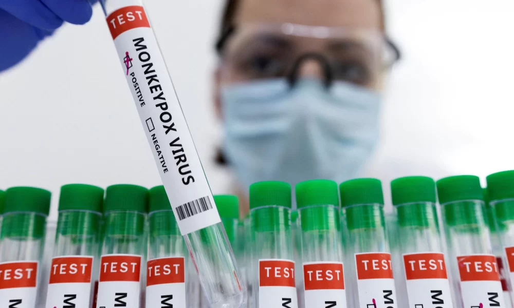 Salud Pública informa sobre dos nuevos casos de la viruela del mono en el país