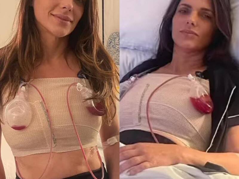 Periodista Bárbara Bermudo publica desgarrador vídeo tras padecer enfermedad de los implantes mamarios